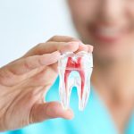 Thiết kế răng sứ